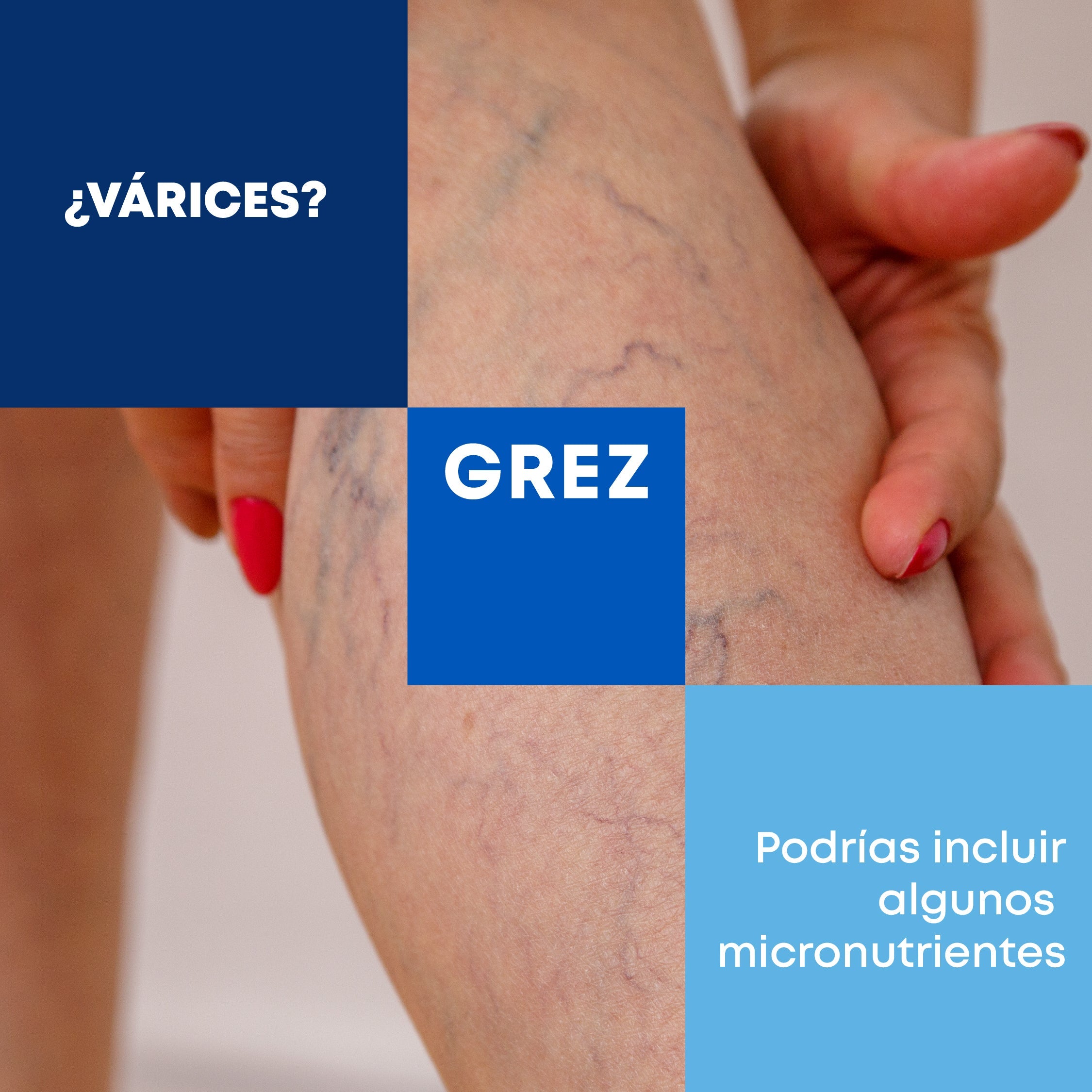 ¿Várices? Podrías incluir algunos micronutrientes