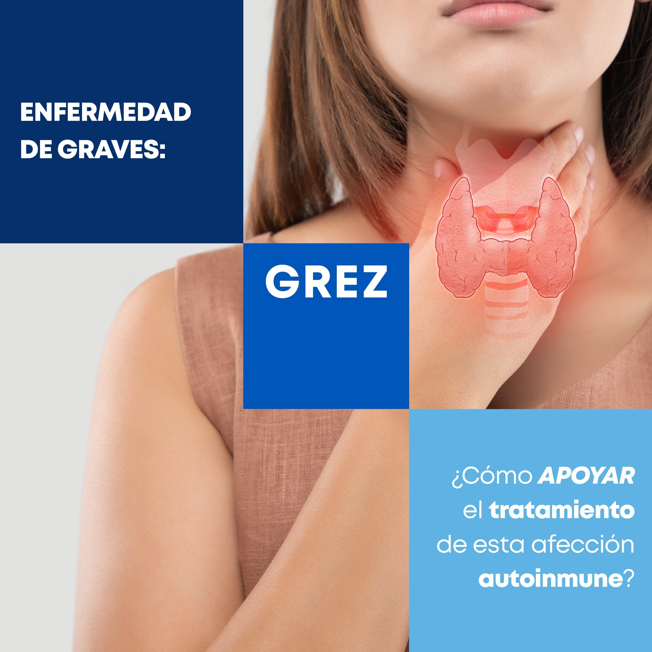 Enfermedad de Graves: ¿Cómo apoyar el tratamiento de esta afección autoinmune?