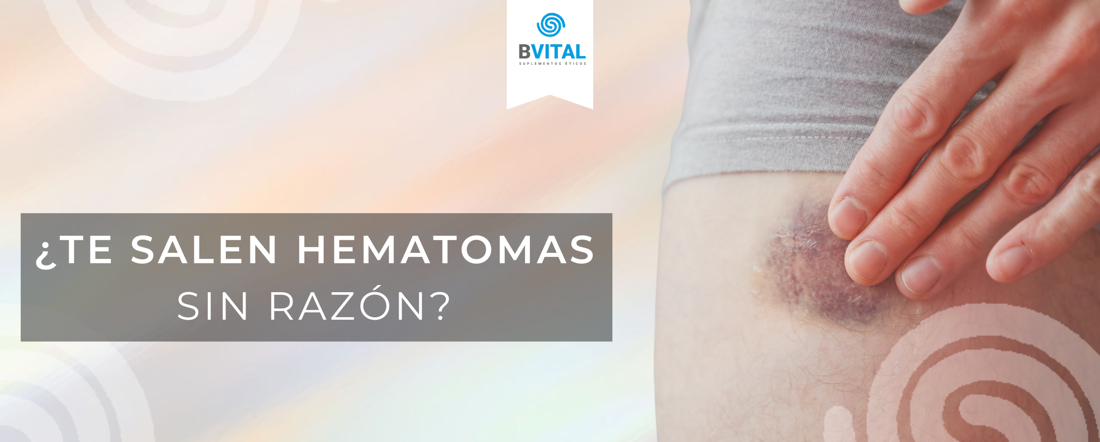 ¿TE SALEN HEMATOMAS SIN RAZÓN?